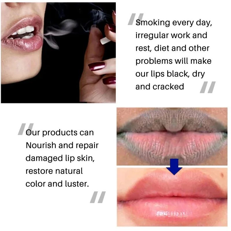 Dark Lip Balm Lightening Mask Ointment