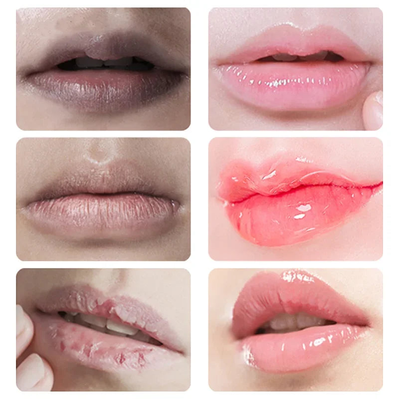 Dark Lip Balm Lightening Mask Ointment